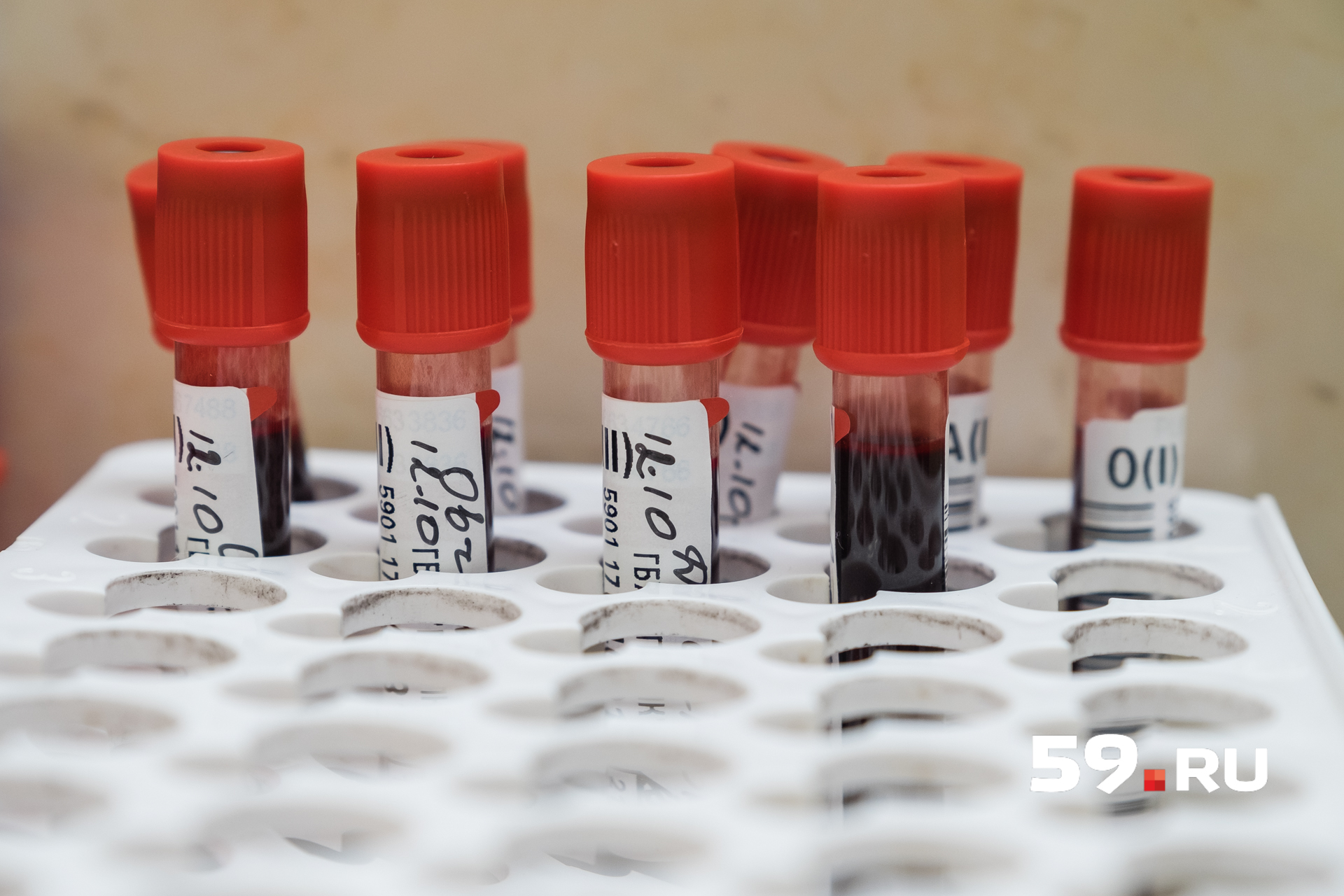 В лабораториях кровь проверяют на вирусы и определяют подходящую для пациента группу