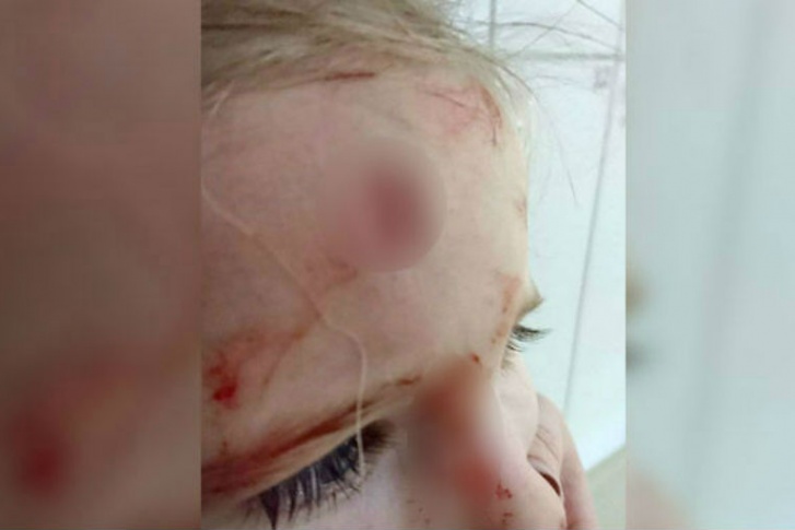 Девочке оказана медицинская помощь Девочке оказана медицинская помощь