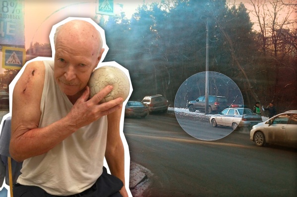 75-летнего пенсионера сбили на пешеходном переходе на улице Лесопарковой. После аварии мужчина не смог до конца восстановить здоровье 75-летнего пенсионера сбили на пешеходном переходе на улице Лесопарковой. После аварии мужчина не смог до конца восстановить здоровье