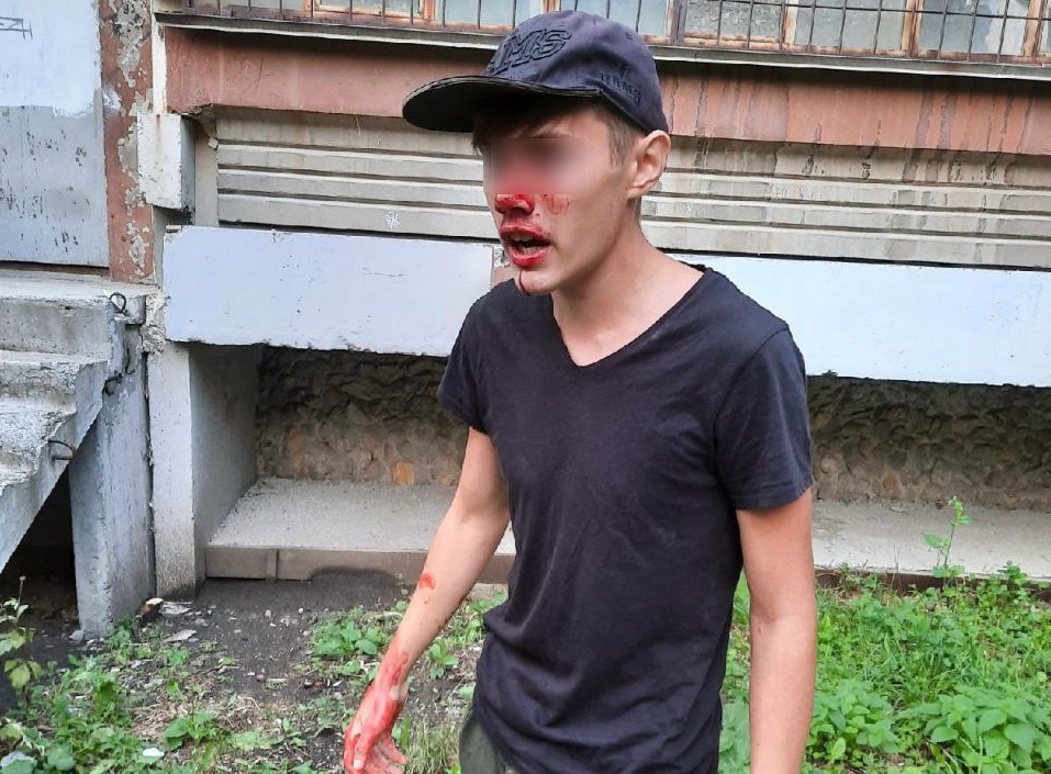 «Дал с ноги мне в лицо»: подросток — о том, как его избил охранник на улице Белинского
