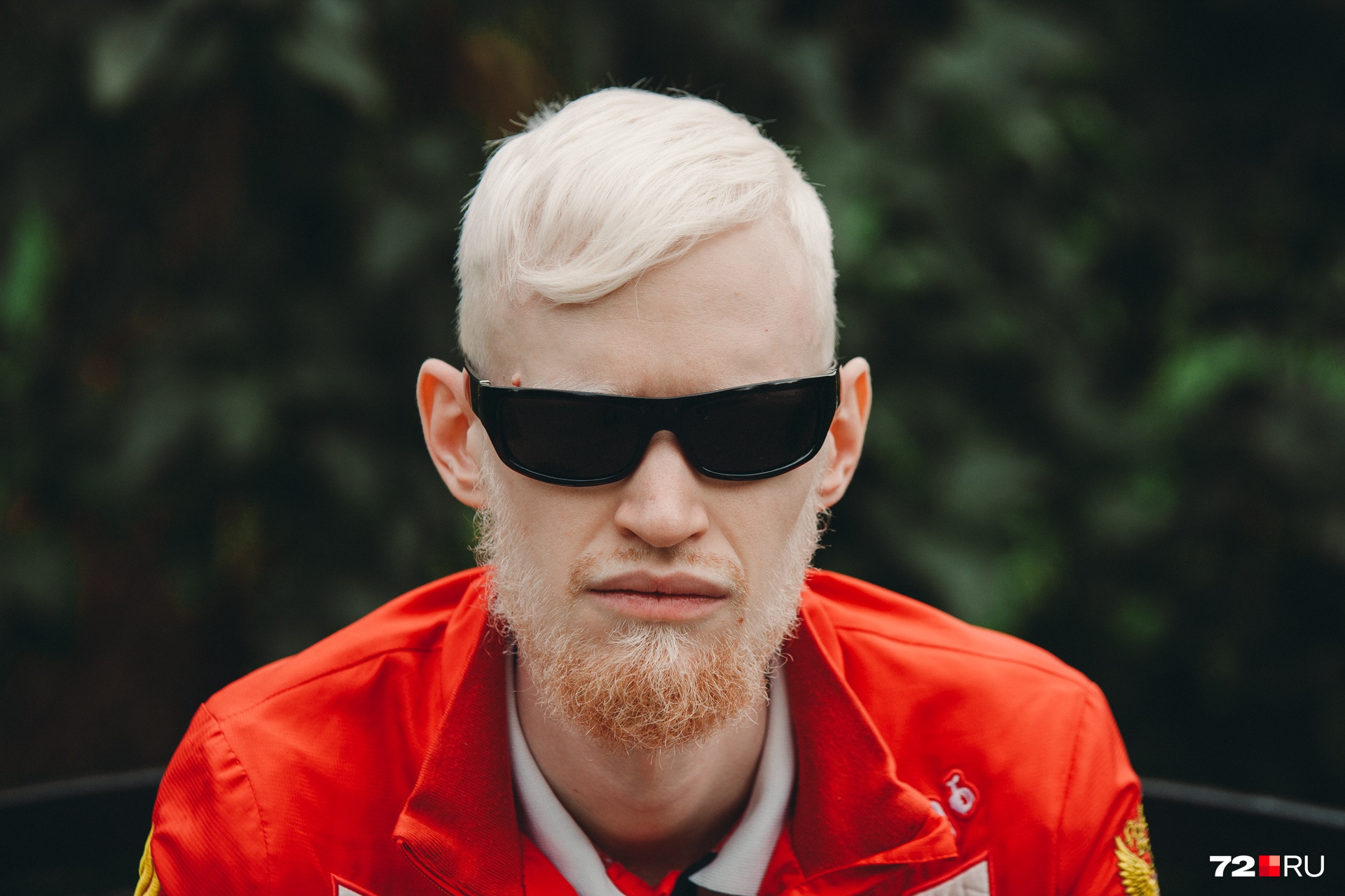 Без очков Ваня практически не выходит из дома. Одно из проявлений альбинизма — проблемы со зрением. Также возможны проблемы со слухом