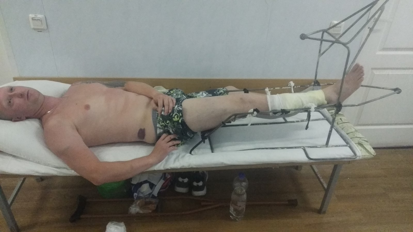 У Дениса Жданова порваны мягкие ткани и множественные гематомы У Дениса Жданова порваны мягкие ткани и множественные гематомы