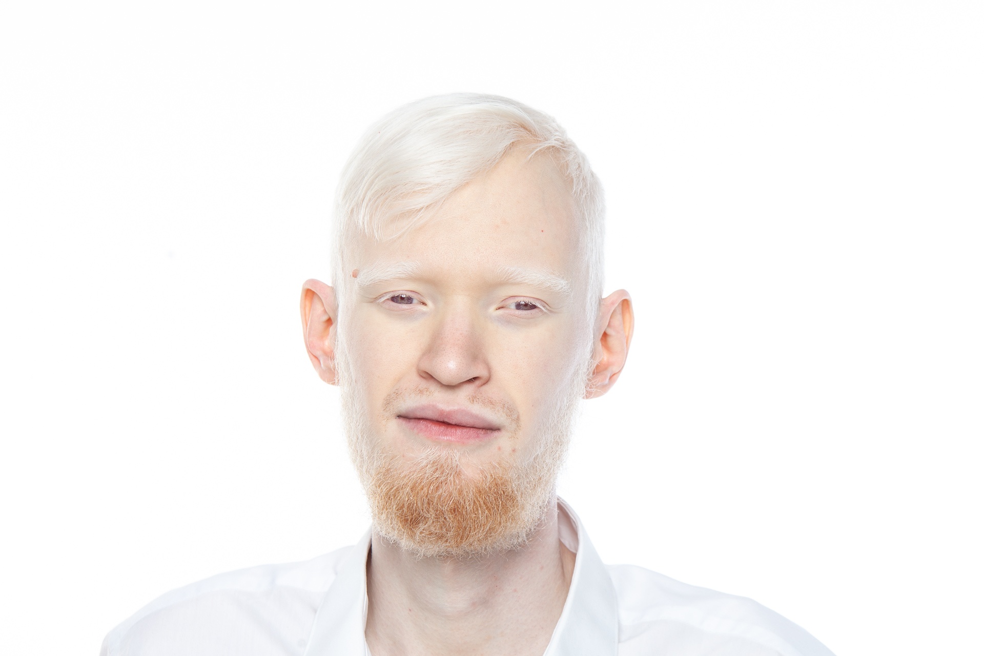 негр и азиат альбинос фото 114