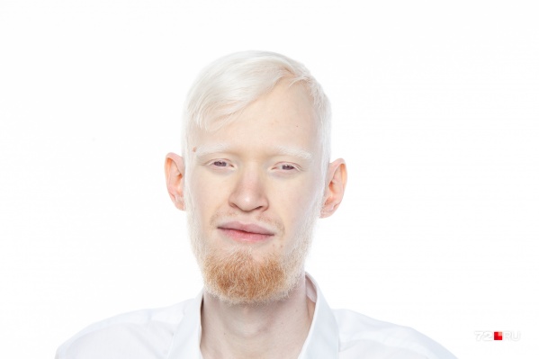 Альбиносы Люди Фото
