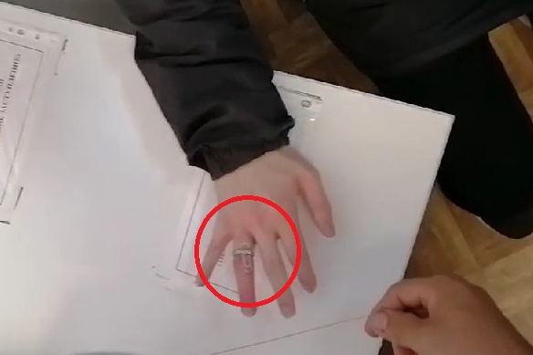 Кольцо удалось снять за считаные секунды Кольцо удалось снять за считаные секунды