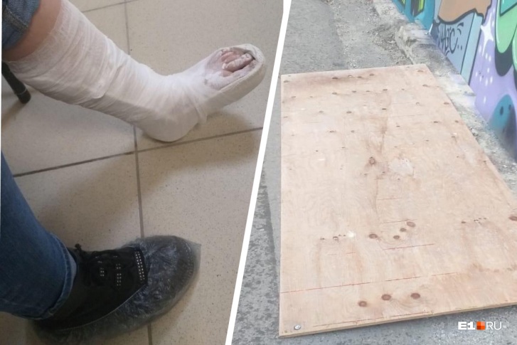 Фанера упала на ногу девочки Фанера упала на ногу девочки