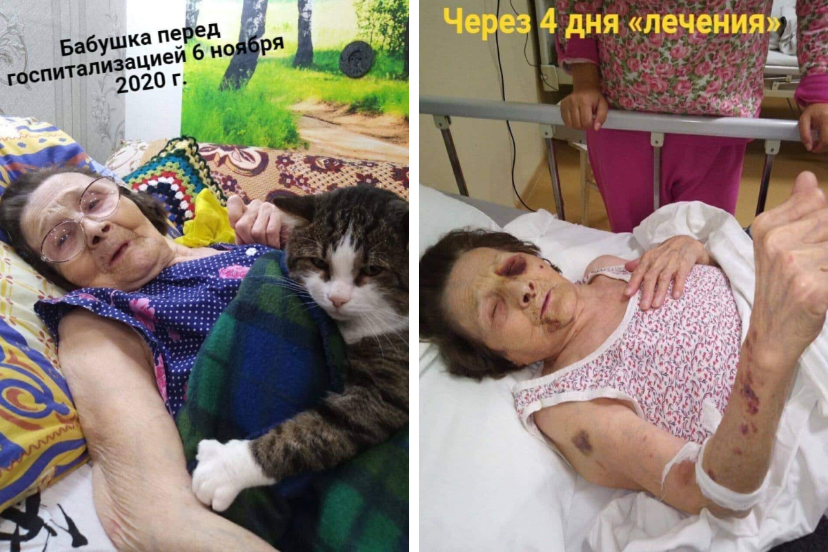 На фото пенсионерка до и после госпитализации На фото пенсионерка до и после госпитализации 