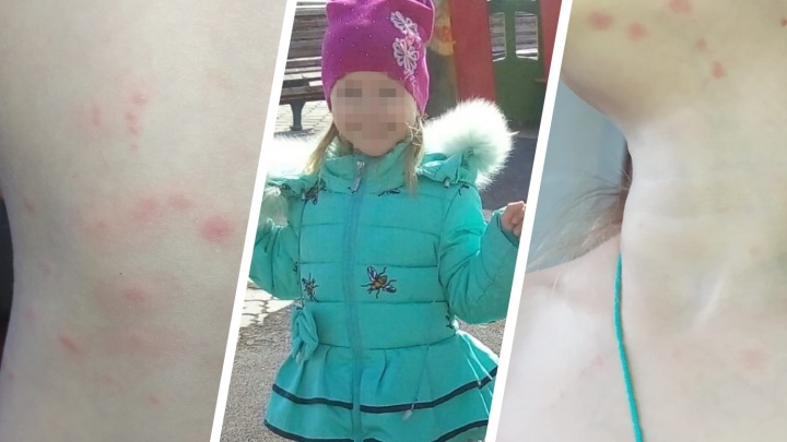 Пятилетнюю девочку, которую всю ночь искали в Челябинске, вернули из приюта домой всю в пятнах