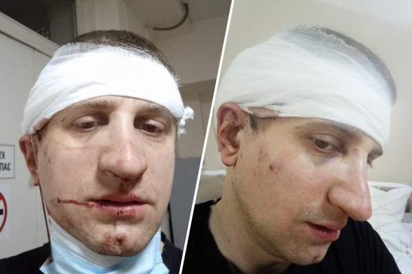Романа Иванова избили после небольшого ДТП Романа Иванова избили после небольшого ДТП