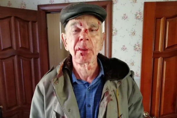 Ивана Галухина беспричинно избили на улице во время прогулки с собакой Ивана Галухина беспричинно избили на улице во время прогулки с собакой
