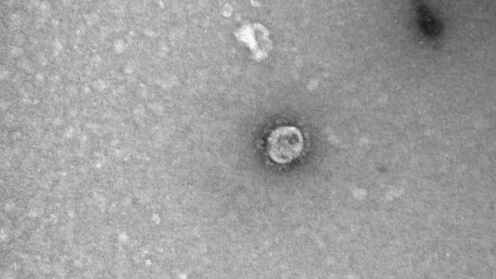 Российские ученые сфотографировали коронавирус. Посмотрите на него