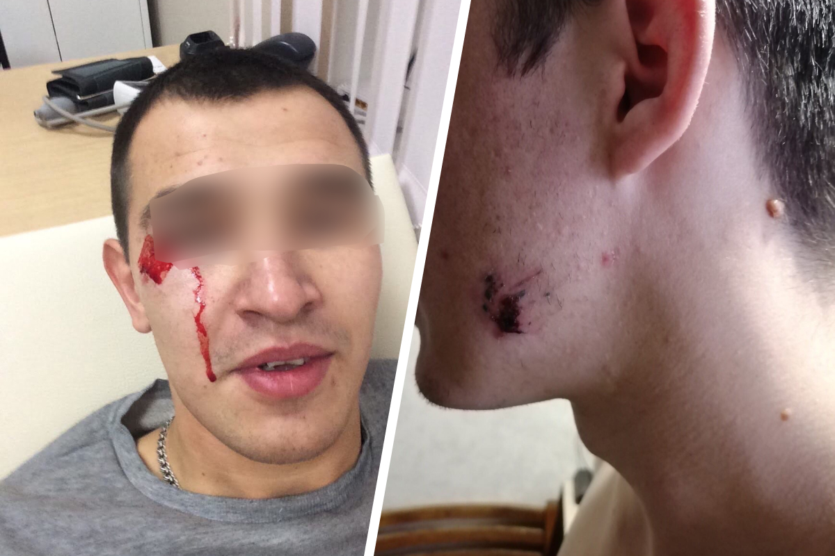 Охранники получили травмы в тот вечер. Одному рассекли бровь, второму чуть не откусили щеку Охранники получили травмы в тот вечер. Одному рассекли бровь, второму чуть не откусили щеку 
