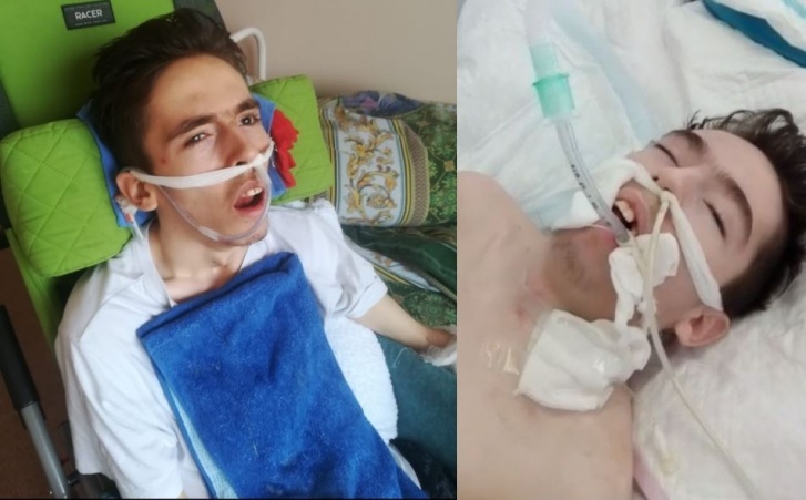 Слева — снимок 15 апреля: Назар был в сознании и дышал самостоятельно. После ухудшения состояния его перевели в реанимацию, и насколько можно судить по видео, он лежит без сознания