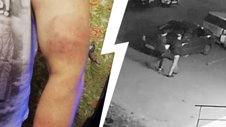 Набросились с трубой и слепили: ярославца жестоко избили в собственной машине. Видео
