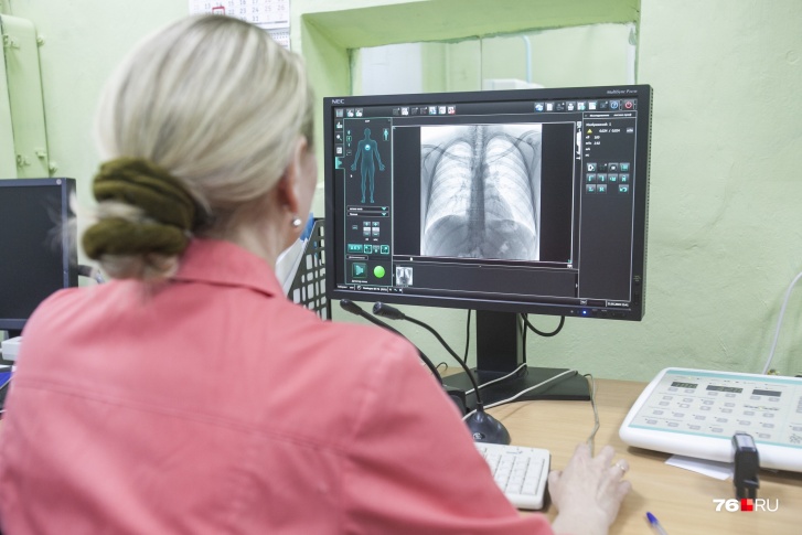 Для профилактики ярославцам рекомендуют раз в год делать флюорографию лёгких 
