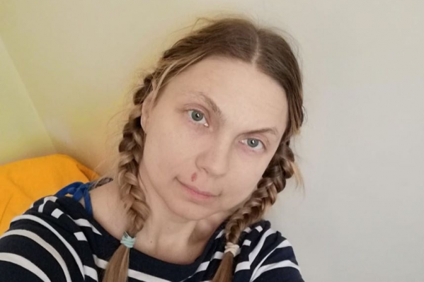 Лариса Кинслер в больничной палате Лариса Кинслер в больничной палате