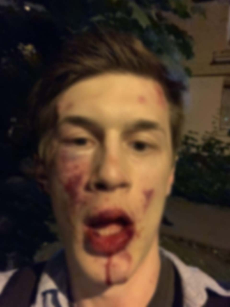 «Лицо у него прям всмятку». В Москве избили активиста Егора Жукова