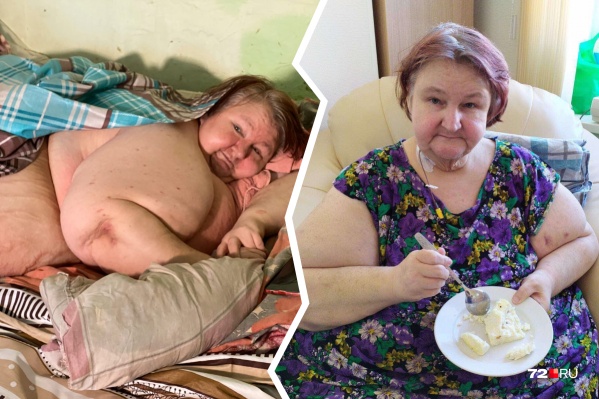 Снимок слева сделан два месяца назад, когда женщина весила 350 кило. На фото справа — Любовь Нурдинова сейчас (её вес теперь — 158 килограммов) Снимок слева сделан два месяца назад, когда женщина весила 350 кило. На фото справа — Любовь Нурдинова сейчас (её вес теперь — 158 килограммов)
