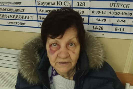 Также женщина разбила лицо и нос Также женщина разбила лицо и нос