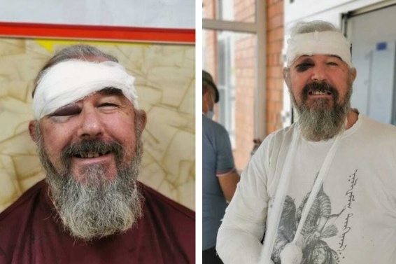 Сергей Зигунов в момент нахождения в больнице Сергей Зигунов в момент нахождения в больнице