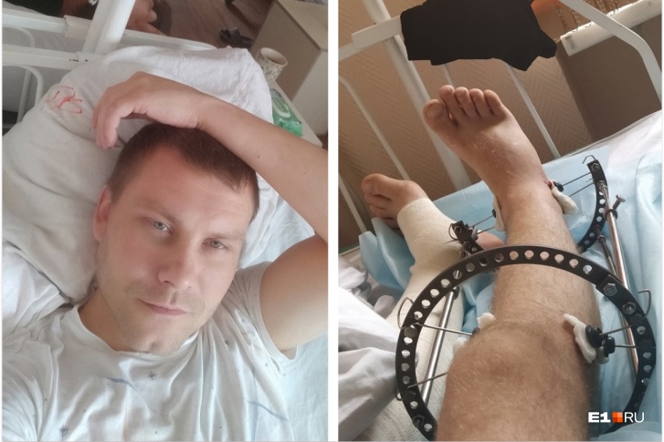 После нападения Сергей перенес три операции на ноге После нападения Сергей перенес три операции на ноге