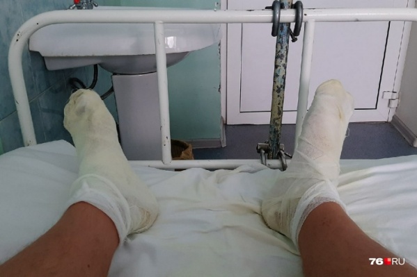 Рыбинец с ожогами ног угодил в больницу имени Пирогова<br> Рыбинец с ожогами ног угодил в больницу имени Пирогова<br>