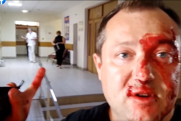 Лицо Полушина в крови, он считает, что его пытались спровоцировать Лицо Полушина в крови, он считает, что его пытались спровоцировать