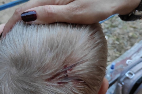 Крепление попало по голове Крепление попало по голове