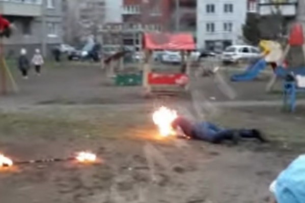Во время представления огонь перекинулся на лицо факира Во время представления огонь перекинулся на лицо факира