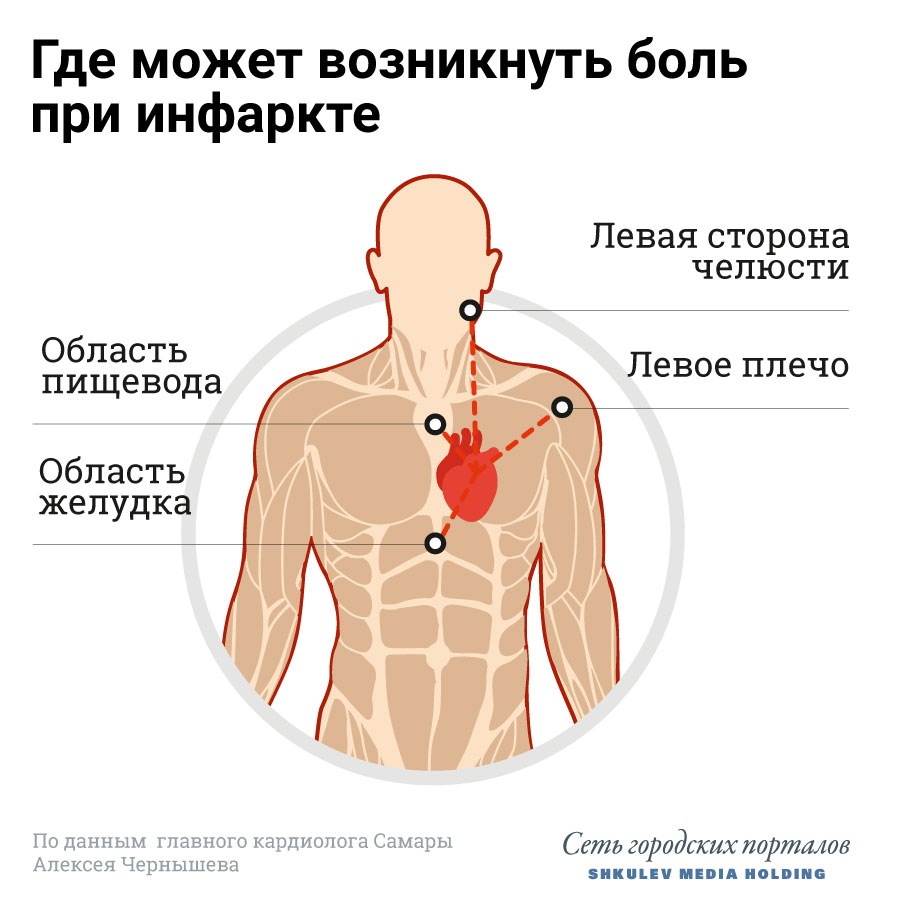Инфаркт может случиться в любом органе, но чаще всего — в сердце