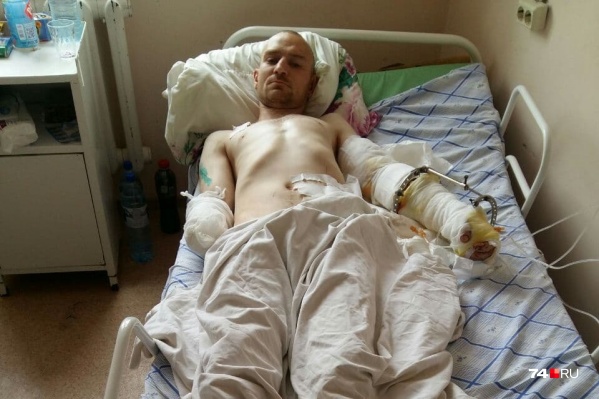 Дмитрий после нападения овчарки остался инвалидом — кисть правой руки у него ампутирована Дмитрий после нападения овчарки остался инвалидом — кисть правой руки у него ампутирована