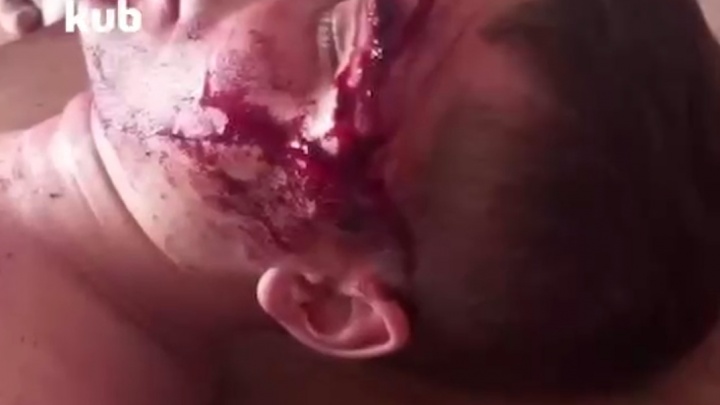 В Музыкальном микрорайоне Краснодара мужчина напал с ножом на прохожего и рассек ему лицо