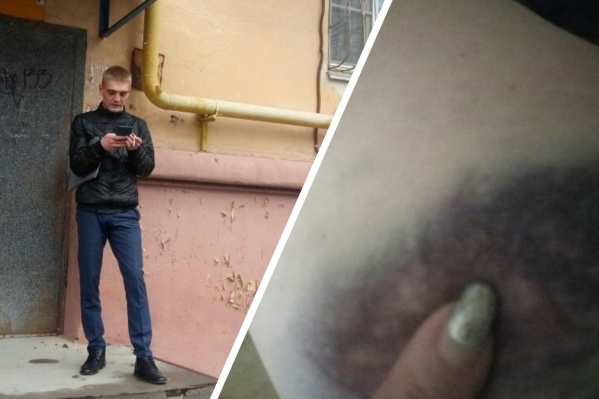 Сегодня волгоградка отправилась в травмпункт Сегодня волгоградка отправилась в травмпункт