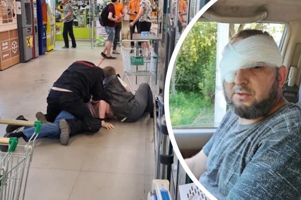 У Мурада поврежден глаз У Мурада поврежден глаз