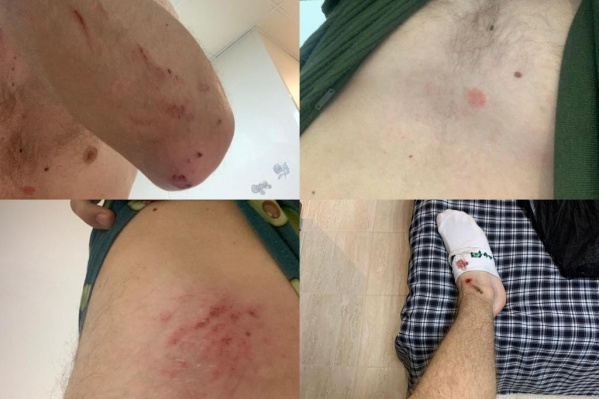 Пострадавший снял все побои и написал заявление в полицию Пострадавший снял все побои и написал заявление в полицию