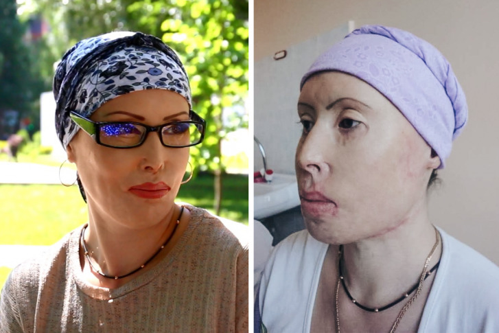Мария проходит лечение уже 7 лет, и оно продолжается<br> Мария проходит лечение уже 7 лет, и оно продолжается<br>