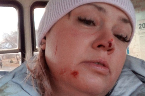 «Била руками и ногами»: в Магнитогорске пассажирка трамвая заявила о нападении кондуктора из-за маски