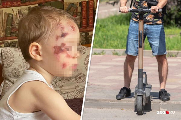 Родители мальчика написали заявление на водителя самоката Родители мальчика написали заявление на водителя самоката