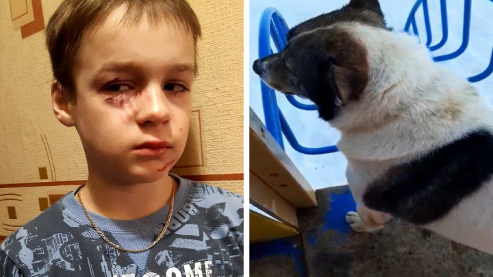 «Пес вцепился в лицо»: в Ярославской области 10-летний мальчик пострадал, спасая девочку от собаки