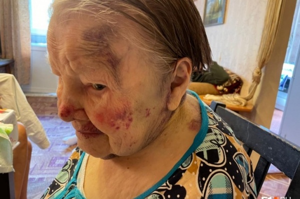 Ольга Андреевна получила травмы 5 августа. Три недели спустя она скончалась Ольга Андреевна получила травмы 5 августа. Три недели спустя она скончалась