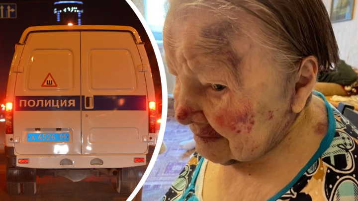 «Она нетранспортабельна»: делом 95-летней бабушки, которую избила сиделка, занялась полиция