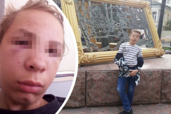 Подростка избили в парке Подростка избили в парке