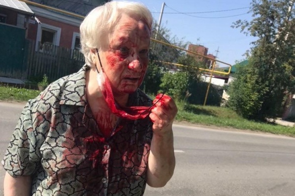Все лицо у пожилой женщины было в крови Все лицо у пожилой женщины было в крови
