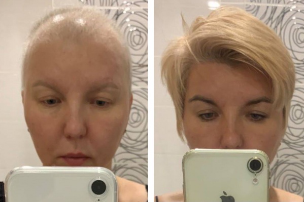 Эти фотографии Лариса сделала до и после лечения Эти фотографии Лариса сделала до и после лечения