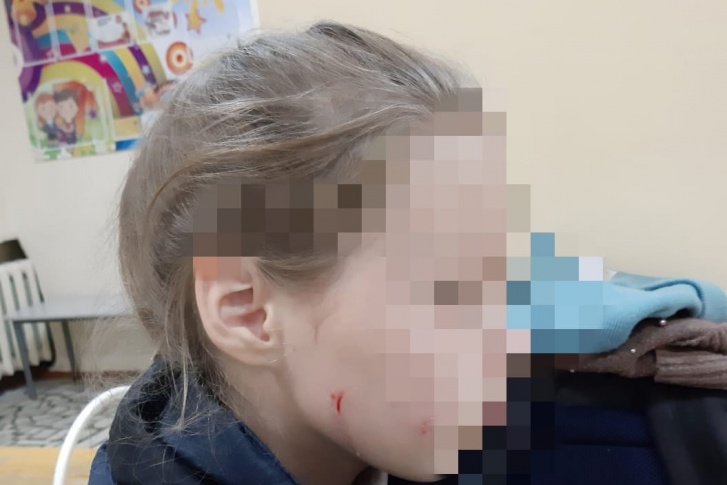 По словам дяди, нападавшая била девочку головой об стенку По словам дяди, нападавшая била девочку головой об стенку