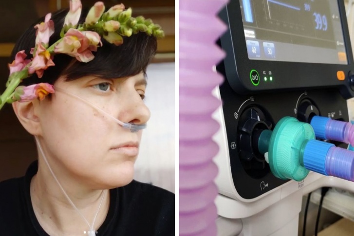 Девушка с детства живет с тяжелой болезнью легких Девушка с детства живет с тяжелой болезнью легких