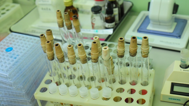Екатеринбуржцев бесплатно проверят на антитела после вакцины, к которой больше всего вопросов