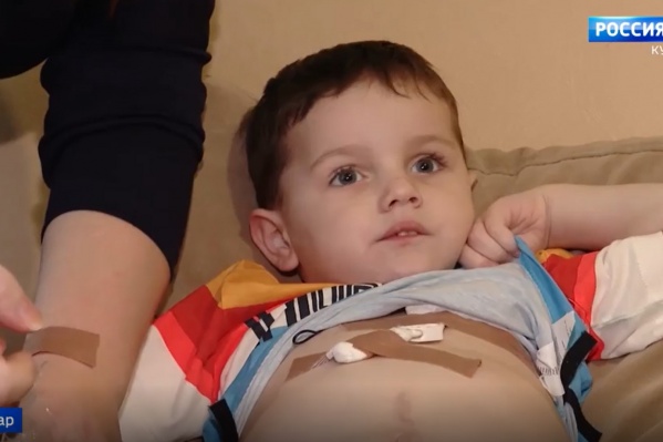 Чтобы получать необходимые питательные вещества, мальчику подключили центральный венозный катетер Чтобы получать необходимые питательные вещества, мальчику подключили центральный венозный катетер