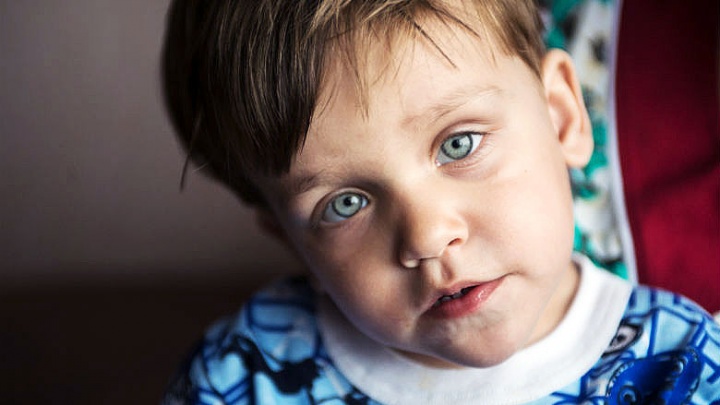 Мальчик из Шарыпово с сильным сколиозом и генетической болезнью поедет на лечение уже в июле