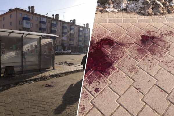 Пока до конца не установлено, чем орудовал подозреваемый — ножом или кастетом Пока до конца не установлено, чем орудовал подозреваемый — ножом или кастетом